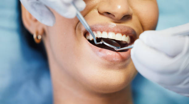 Best Emergency Treatment for Toothache in Santa Moni, CA